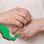 Gobierno dejó de gastar 70 % de recursos destinados a vacunas incluidas para Sarampión : PAN Gobierno dejó de gastar 70 % de recursos destinados a vacunas incluidas para Sarampión : PAN